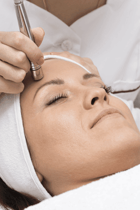Microneedling Before & After