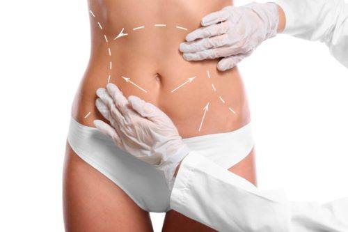 CoolSculpting Services: Body Contouring