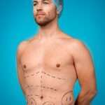 Body Contouring and Sculpting: Contouring for Confidence