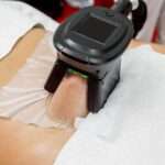 CoolSculpting