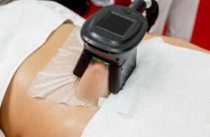 Efficacy and Safety of CoolSculpting