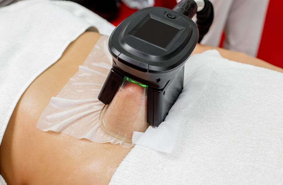 CoolSculpting