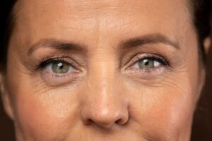 Beyond Wrinkles