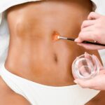 Body Contouring and Sculpting: Precision Body Shaping