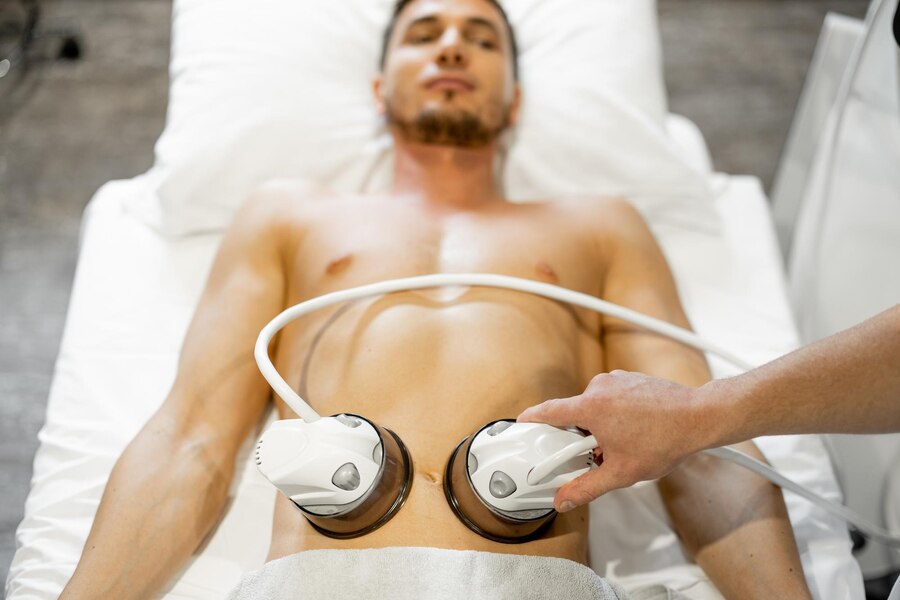 coolsculpting for men Lubbock