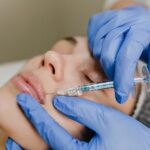Juvederm Injections (1)