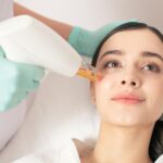 Microneedling for Wrinkles and Fine Lines