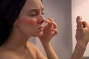 Skin Sensitivity