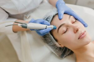 Microneedling And Confidence Boost