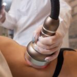 CoolSculpting Rates Midland