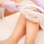 Laser Hair Removal