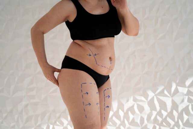 woman-s-body-with-marker-traces-side-view_23-2149350067