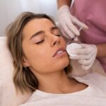Cheek Juvederm
