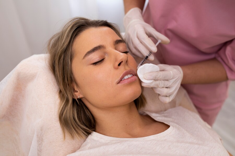 Cheek Juvederm