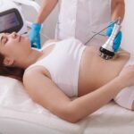 CoolSculpting