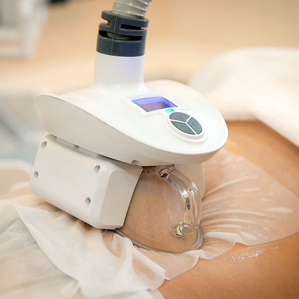 Non-Surgical Fat Removal Corpus Christi