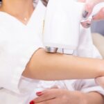 cool sculpting arms