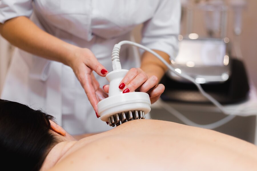 coolsculpting