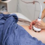 CoolSculpting