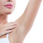 affordable laser hair removal