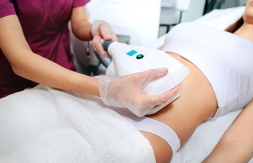 CoolSculpting in Corpus Christi