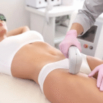 Bikini Laser Hair Removal