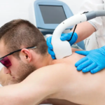 Certified Laser Hair Removal