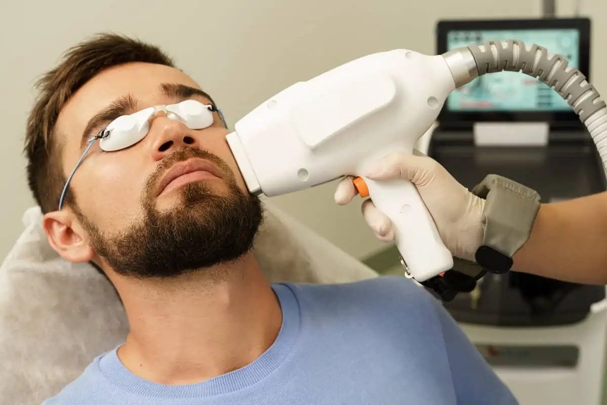  Laser Hair Removal for Men