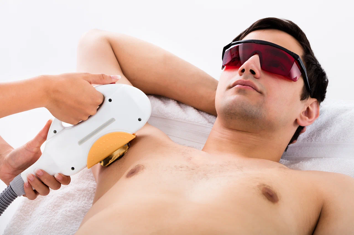 Laser Hair Removal for Men