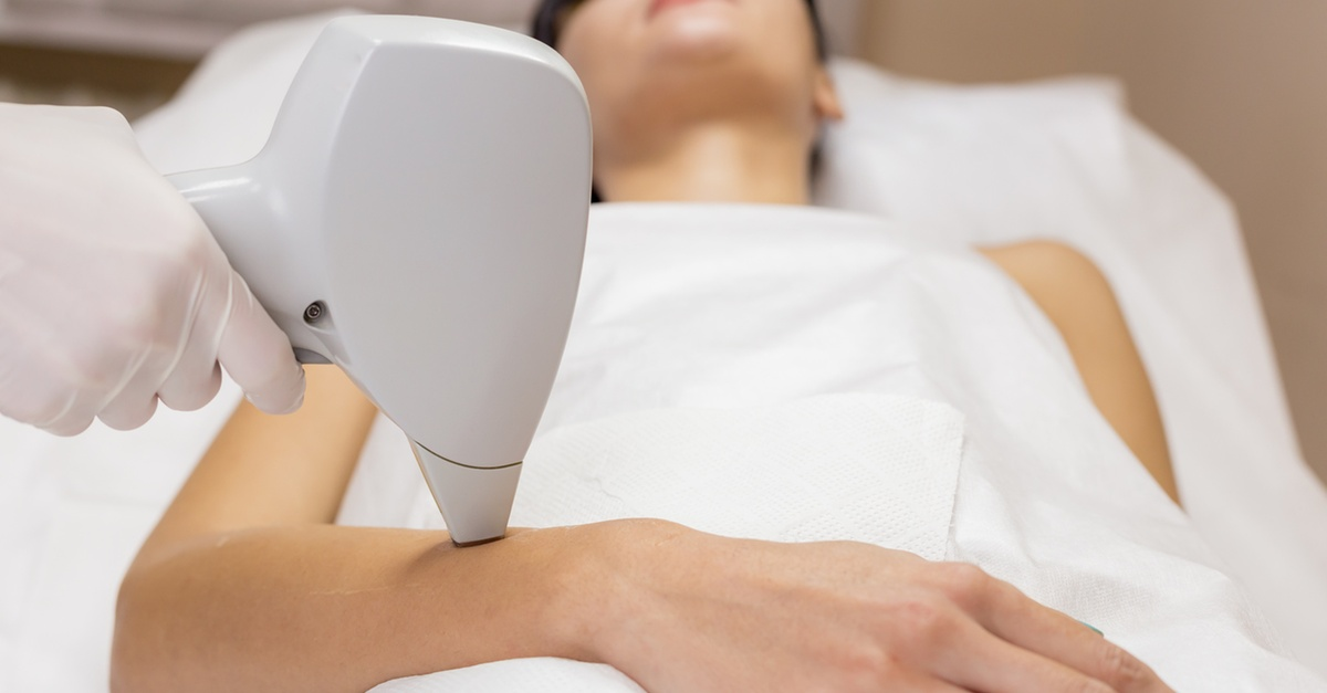 Painless Laser Hair Removal