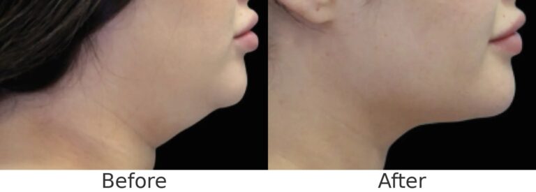 CS Chin